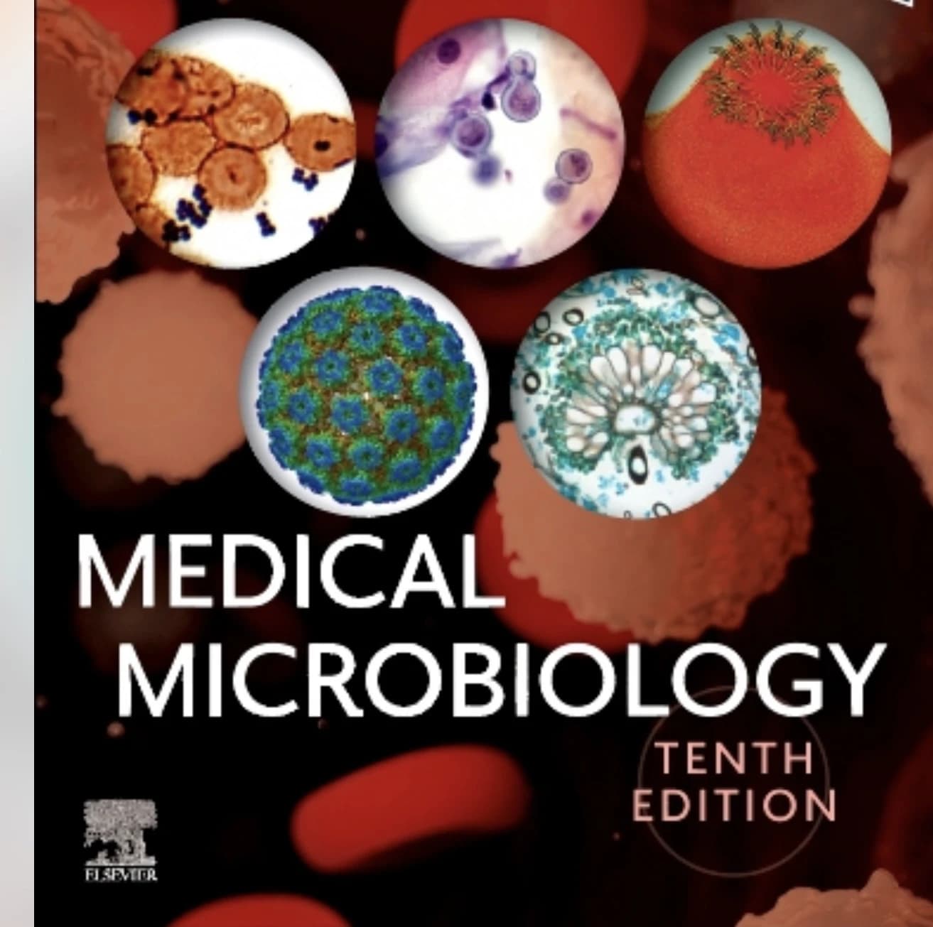 Medical micro Sue